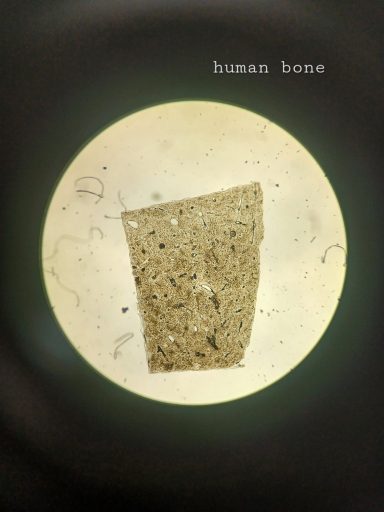 a microscope slide of a human bone sample.