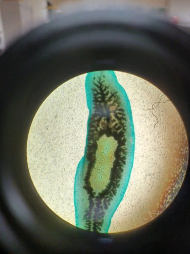 a microscope slide of a stained flat worm