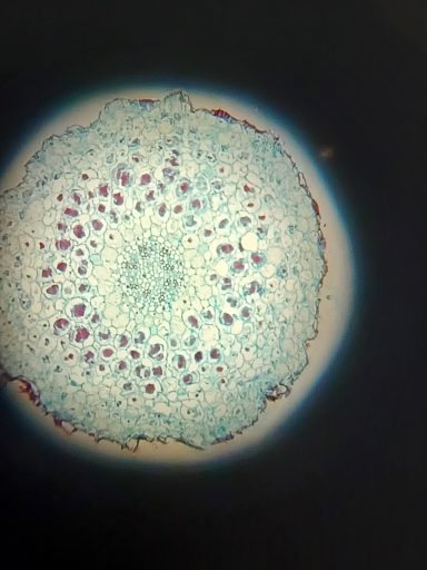microscope slide of a mycorrhiza